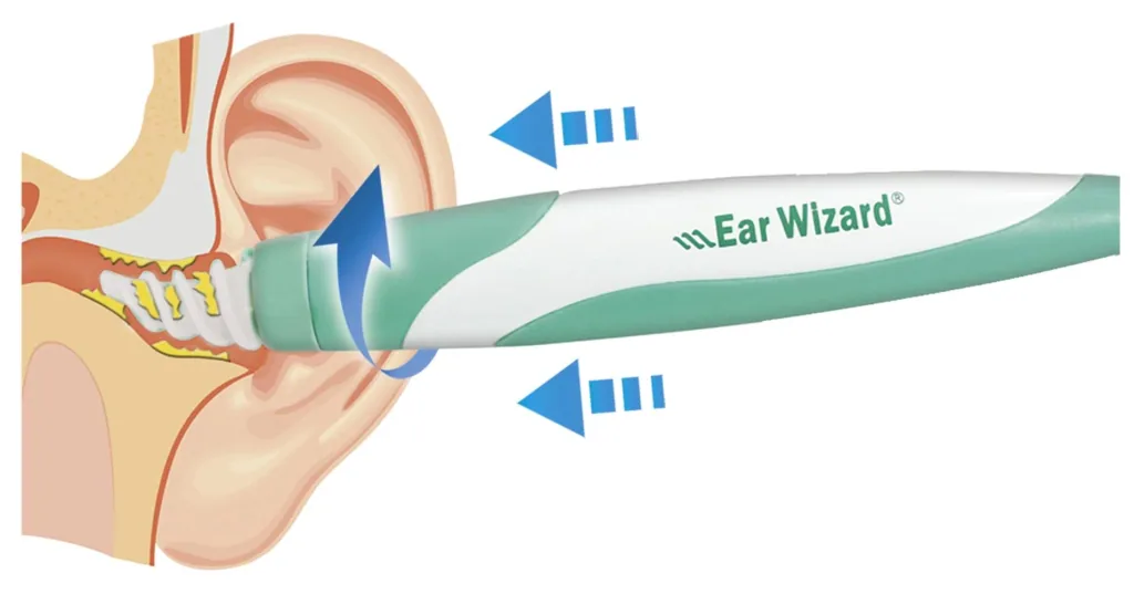 Ohrenreiniger-Set „Ear Wizard“, mit 15 Silikonaufsätzen und Aufbewahrungsbox, 17-teilig