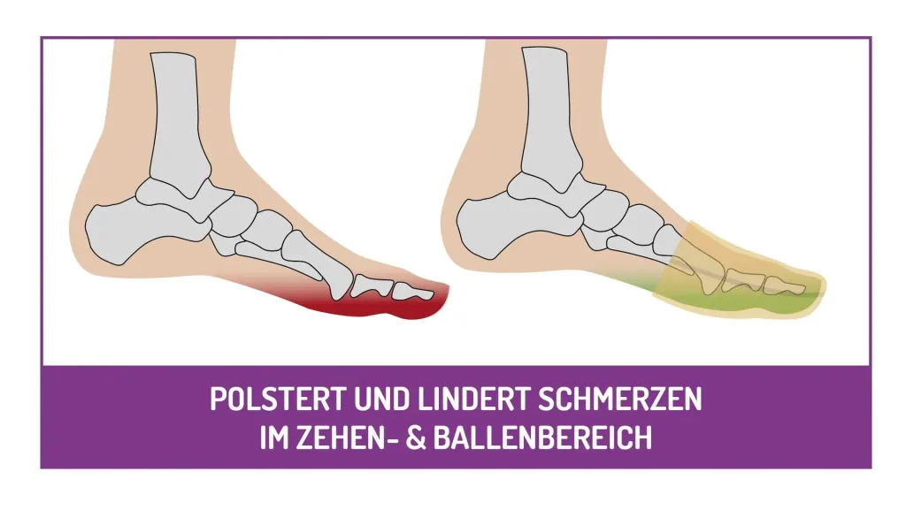Polsterkappe, mit Silber, universal, Beige, 1 Paar